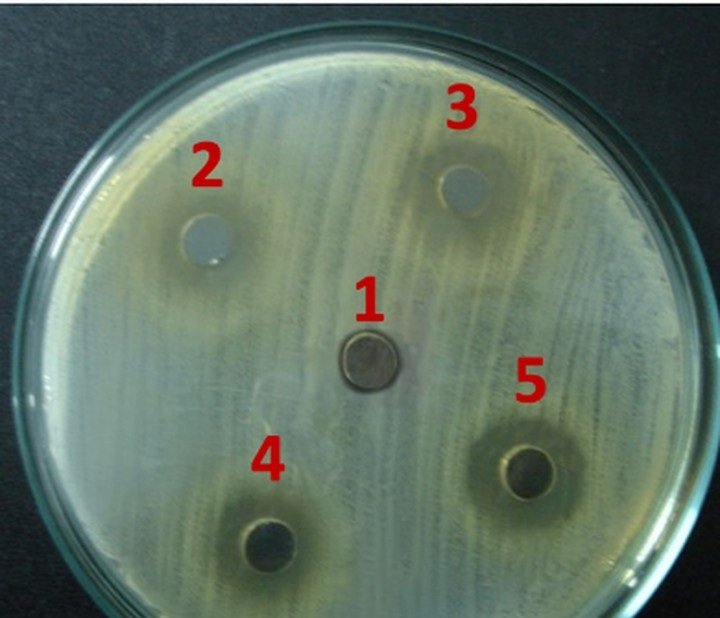Agar plate of methicillin-resistant Staphylococcus aureus showing clear zones of inhibition around the plant-derived discs
