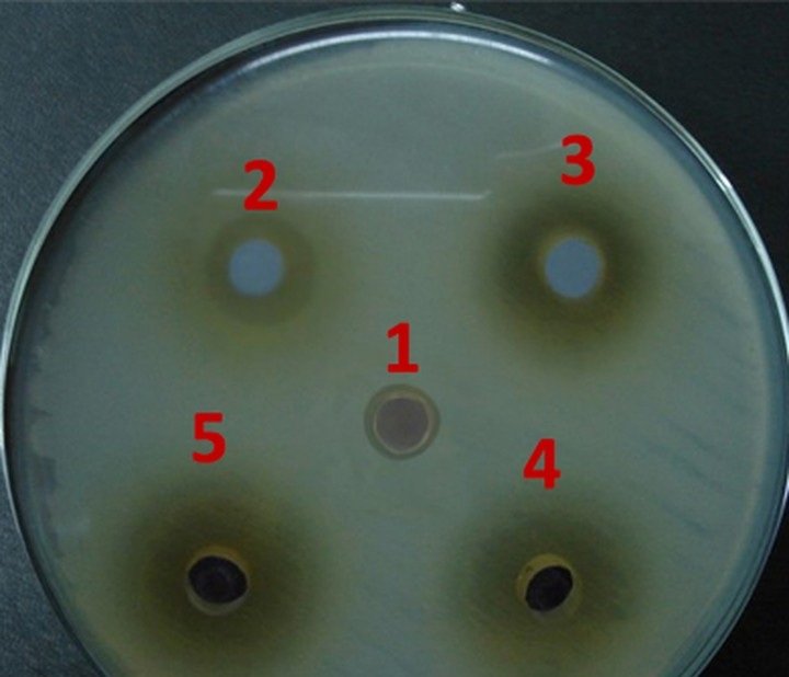 Agar plate of multidrug-resistant Salmonella Typhi showing clear zones of inhibition around the plant-derived discs